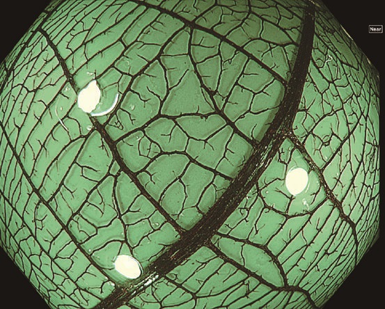 オリンパス:大腸ビデオスコープ  CF-EZ1500DL/I 高感度CMOSセンサー