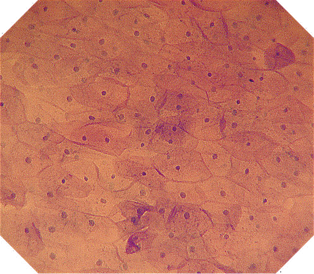 オリンパス：上部消化管汎用ビデオスコープ  GIF-H290EC　EC観察画像