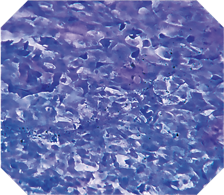 オリンパス：上部消化管汎用ビデオスコープ  GIF-H290EC　EC観察画像