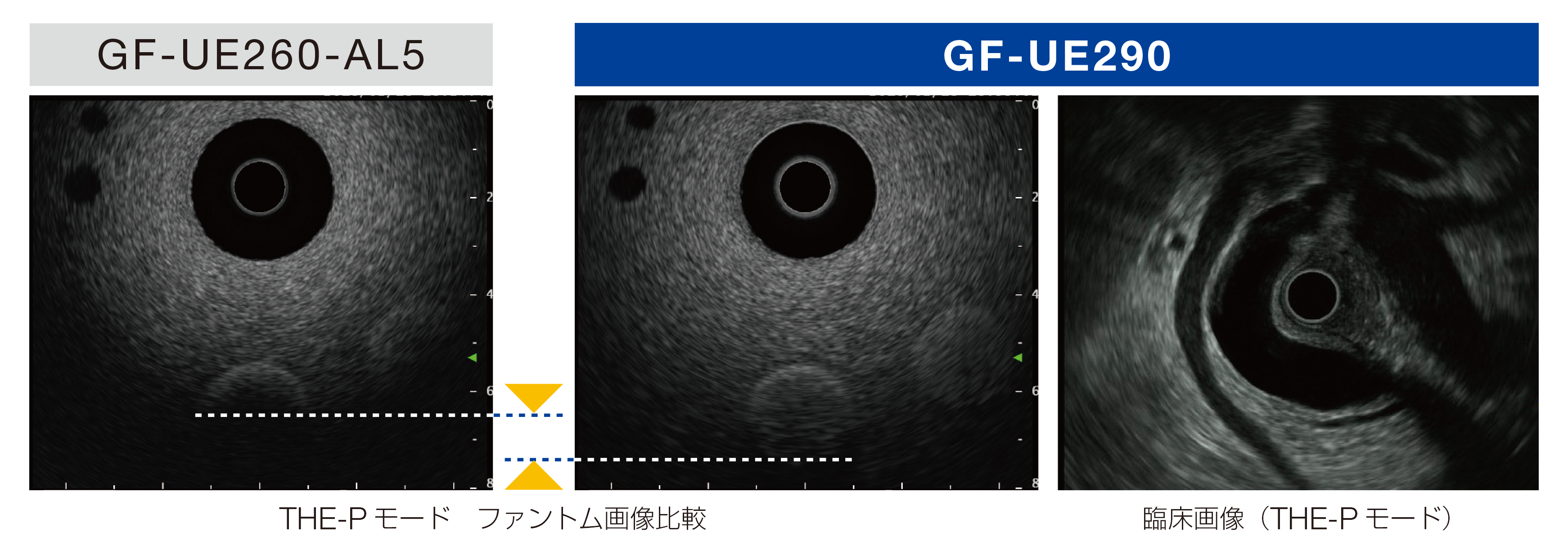 オリンパス:超音波消化管ビデオスコープ GF-UE290 深達度の向上により、質の高いEUS 観察をサポート
