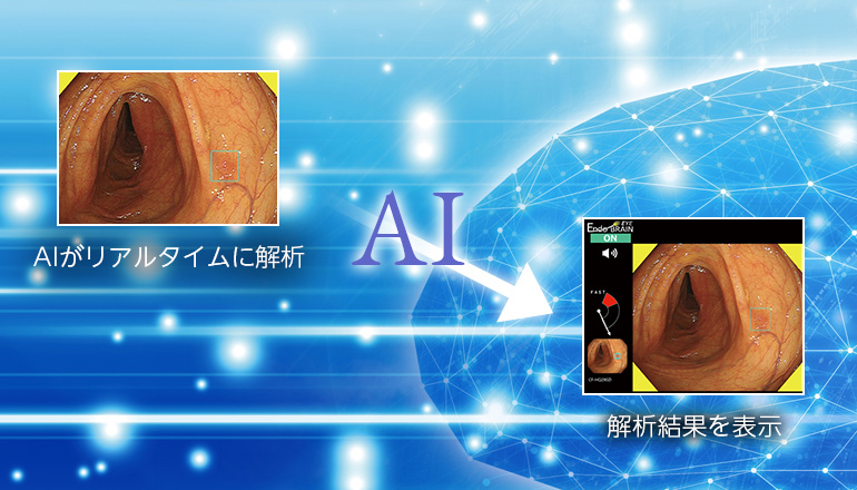 内視鏡画像診断支援ソフトウェア EndoBRAIN|製品情報|オリンパス 内視鏡画像診断支援ソフトウェア EndoBRAIN|製品情報|オリンパス
