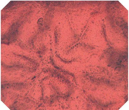 オリンパス：大腸ビデオスコープ  CF-H290ECI　EC観察　非腫瘍（大腸）