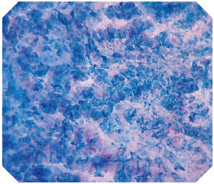 オリンパス：大腸ビデオスコープ  CF-H290ECI　EC観察　非腫瘍（大腸）