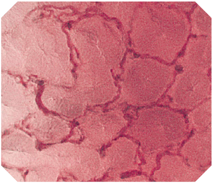 オリンパス：大腸ビデオスコープ  CF-H290ECI　EC-NBI観察　非腫瘍（大腸）