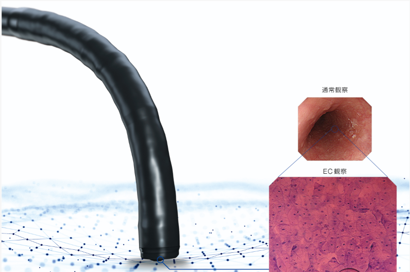 オリンパス:上部消化管汎用ビデオスコープ GIF-H290EC Endocyto観察原理