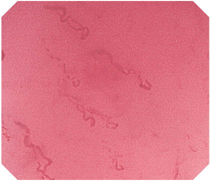 オリンパス：上部消化管汎用ビデオスコープ  GIF-H290EC　EC-NBI観察画像