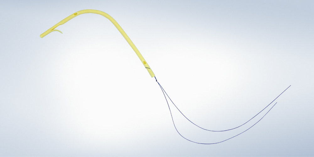 オリンパス：胆管用ステント　UMIDAS STENT　長期開存を目指したインサイドステント