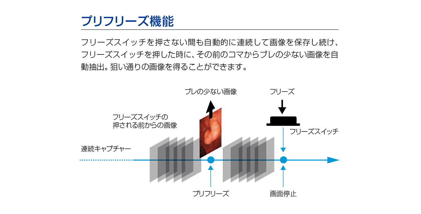 プリフリーズ機能