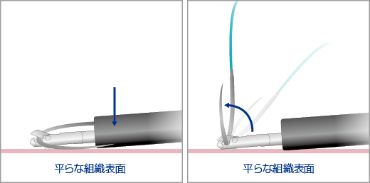 縫合セット　持針器　セーレ 縫合セット 持針器 セーレ - メルカリ