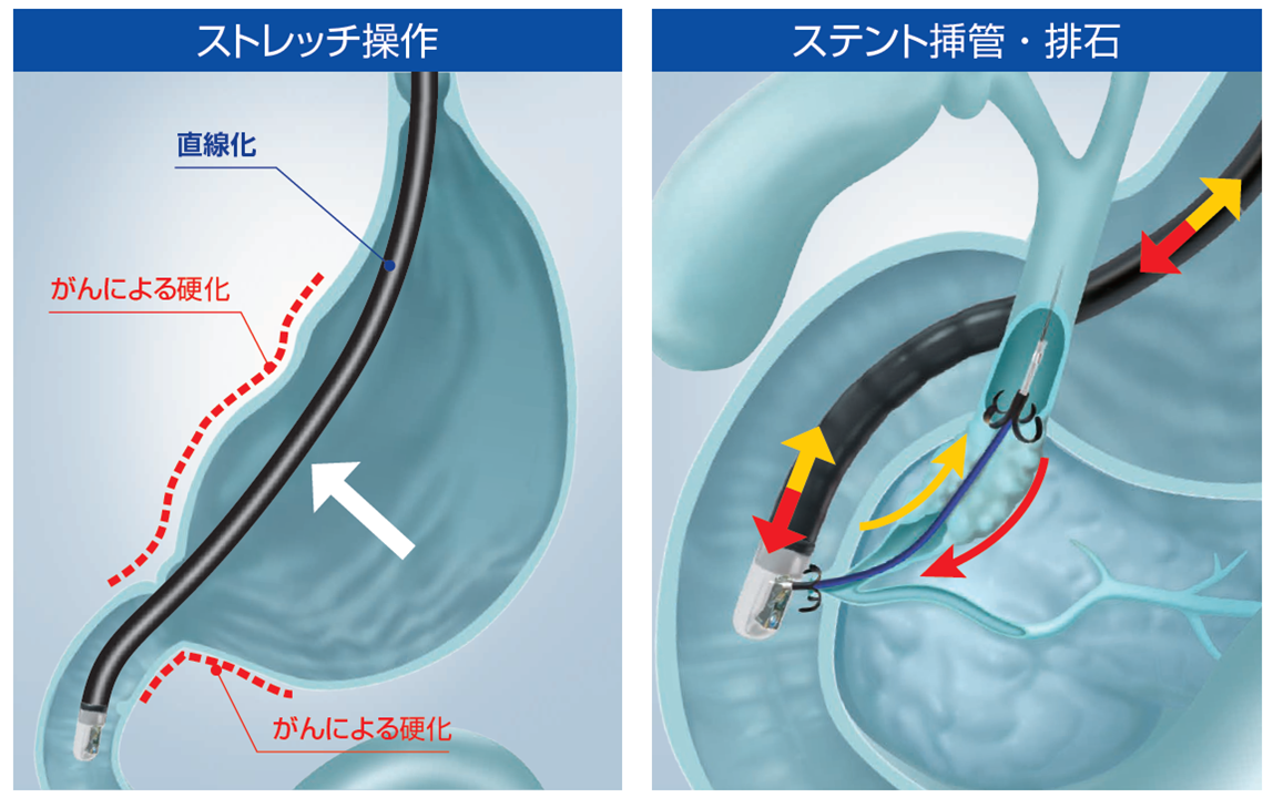 オリンパス:十二指腸ビデオスコープ  TJF-Q290V 高伝達挿入部