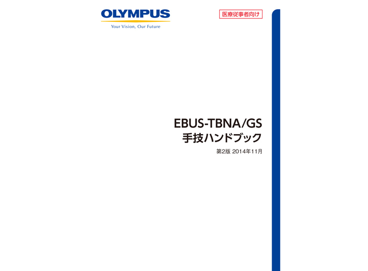 EBUS-TBNA/GS 手技ハンドブック 第2版2014年11月