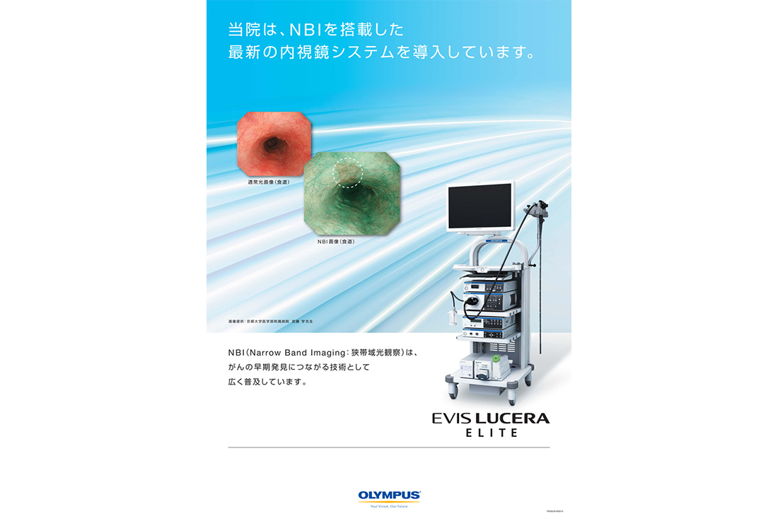 当院は、NBIを搭載した最新の内視鏡システムを導入しています。
