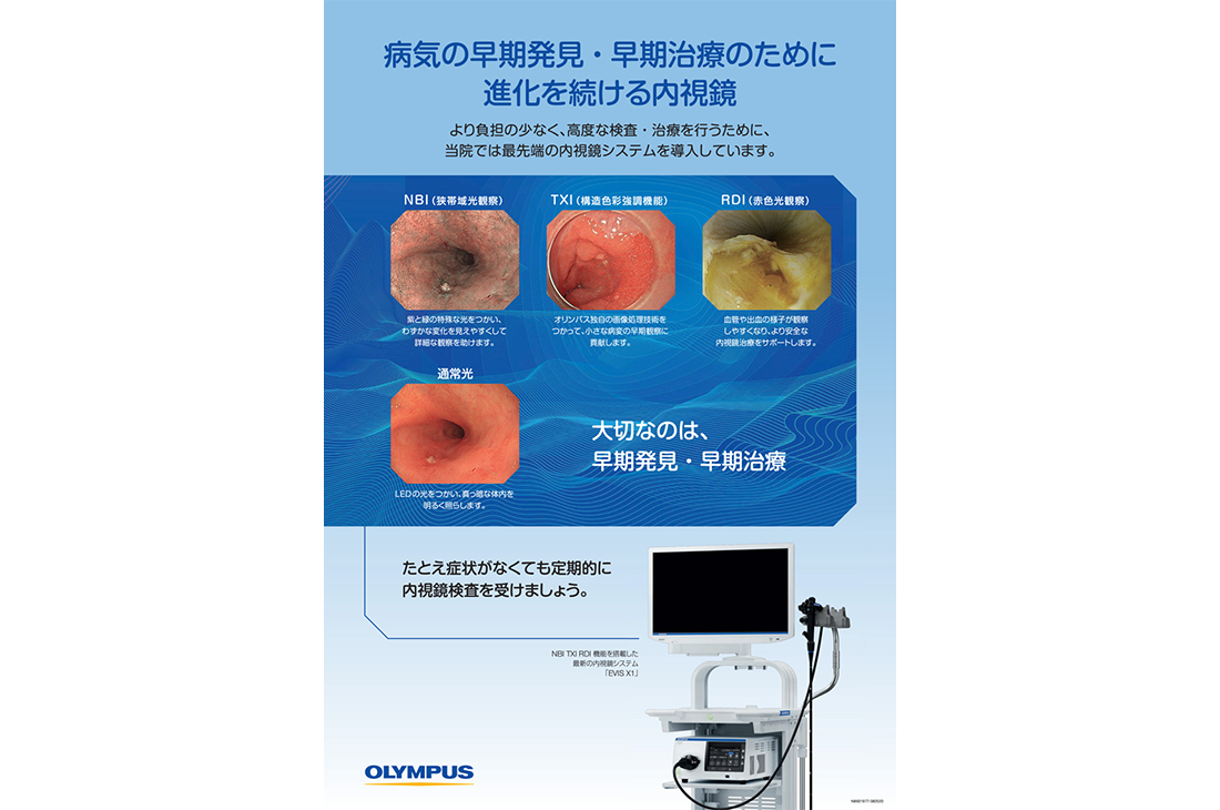 病気の早期発見・早期治療のために進化を続ける内視鏡