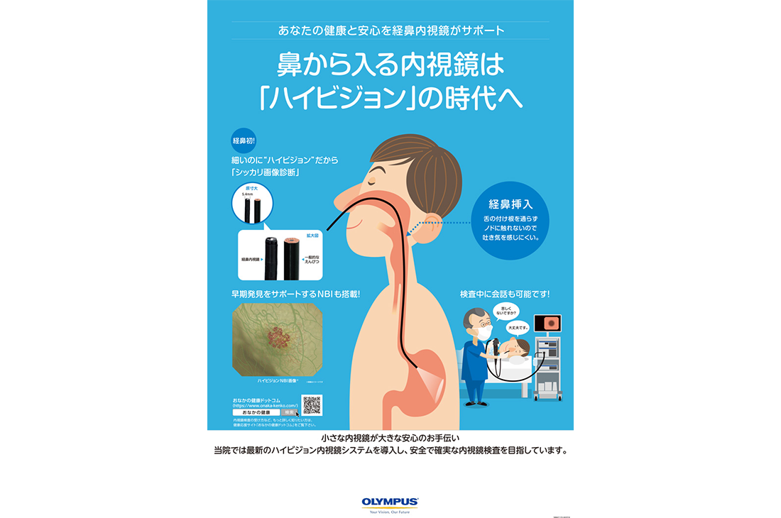 鼻から入る内視鏡は「ハイビジョン」の時代へ
