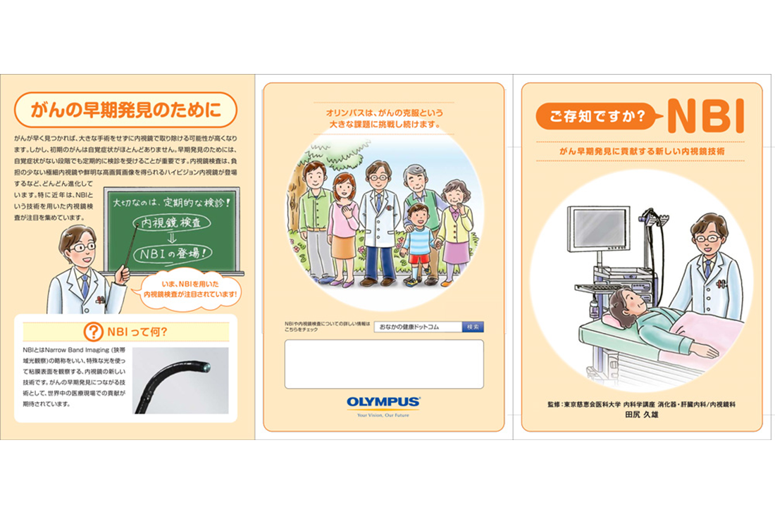 ご存知ですか？NBI