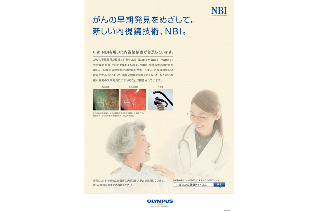 がんの早期発見をめざして。新しい内視鏡技術、NBI。
