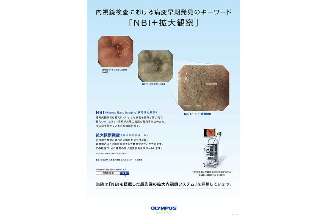 内視鏡検査における病変早期発見のキーワード「NBI+拡大観察」