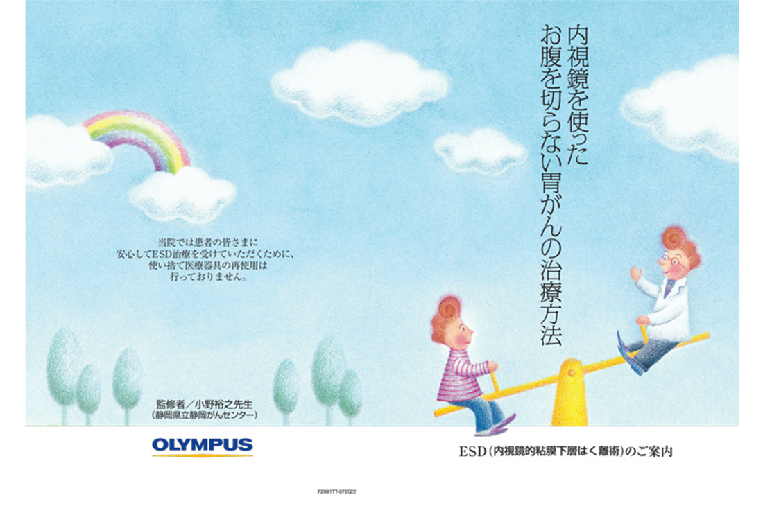 内視鏡を使ったお腹を切らない胃ガンの治療方法