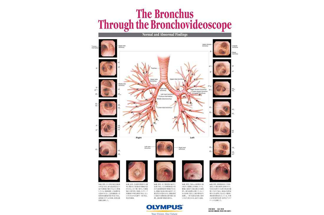 The Bronchus Through the Bronchovideoscope