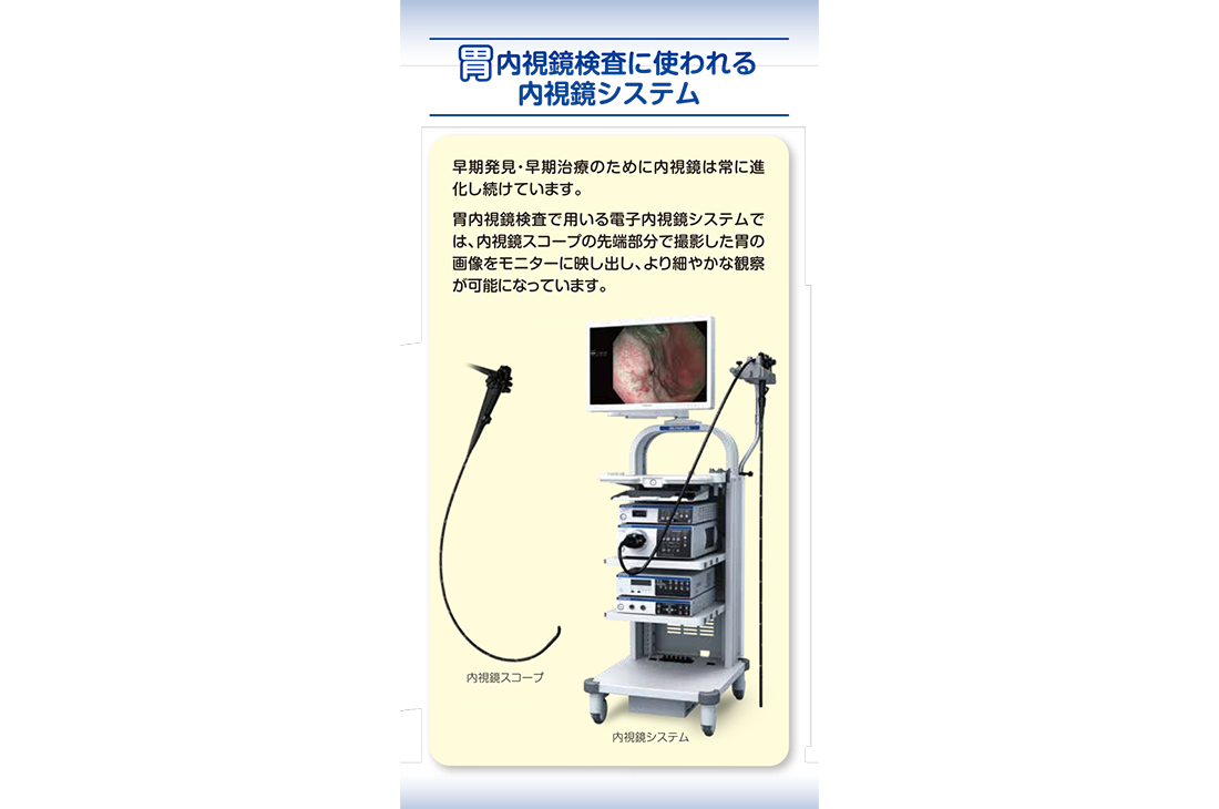 胃内視鏡検査に使われる内視鏡システム