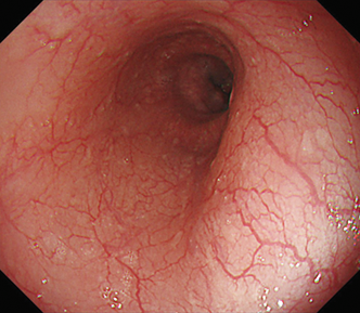 遠景部分において明るい視野が確保できる（血管の例）