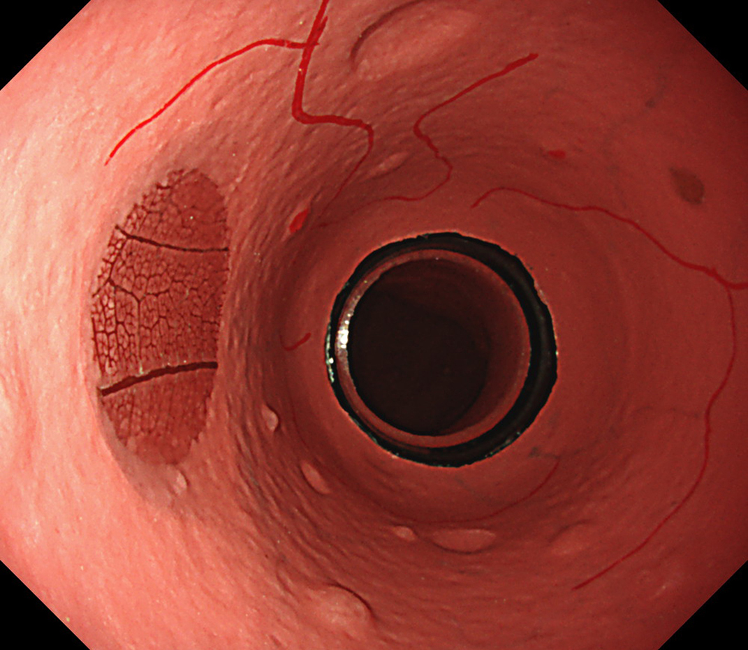 LUCERA ELITE×GIF-1200N