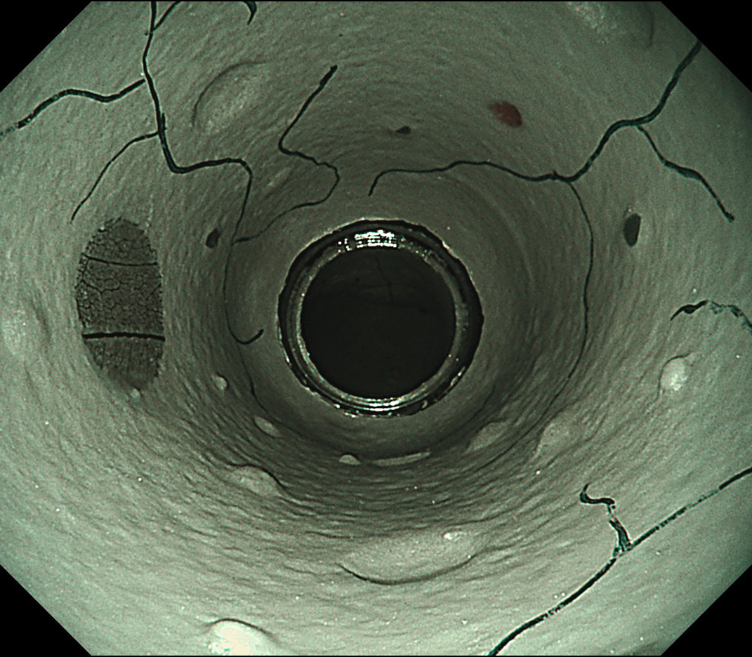 LUCERA ELITE×GIF-1200N