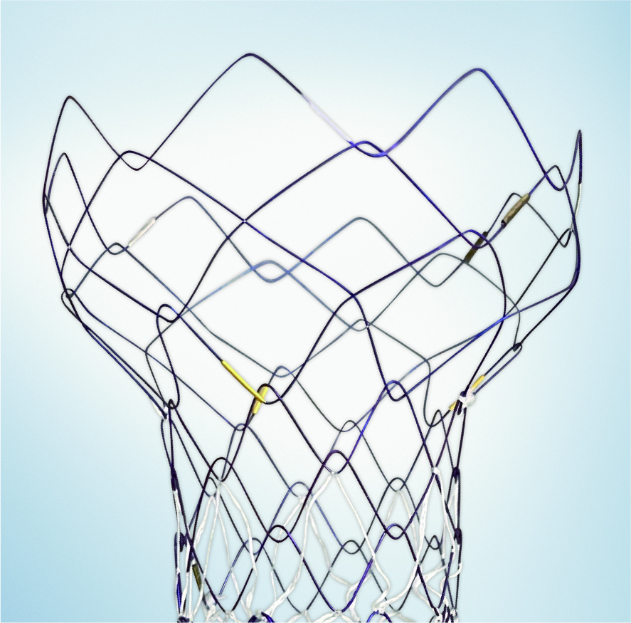 スプライダー 胃十二指腸ステント