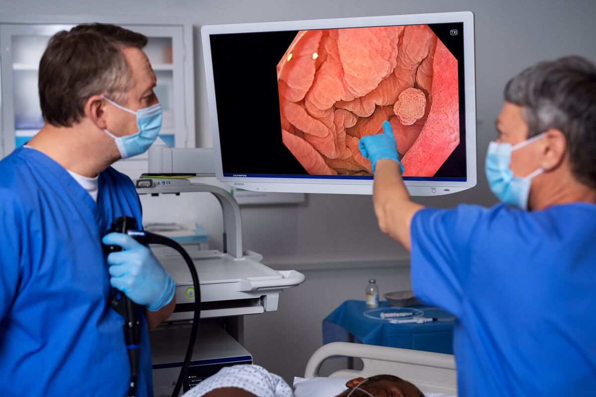 オリンパス：内視鏡システム EVIS X1　TXI機能