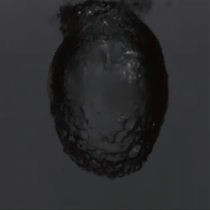 図1/Ho:YAG　バブル形状