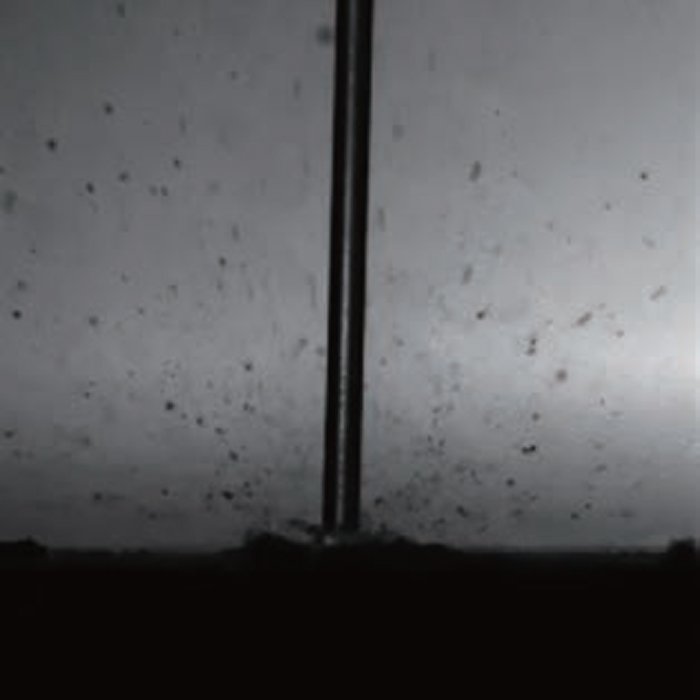 図4/TFL　結石破砕片