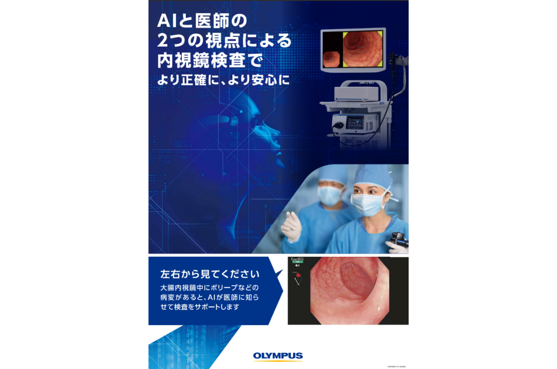AIと医師の2つの視点による内視鏡検査でより正確に、より安心に