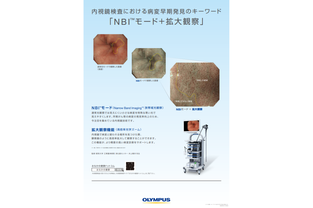 内視鏡検査における病変早期発見のキーワード「NBI+拡大観察」