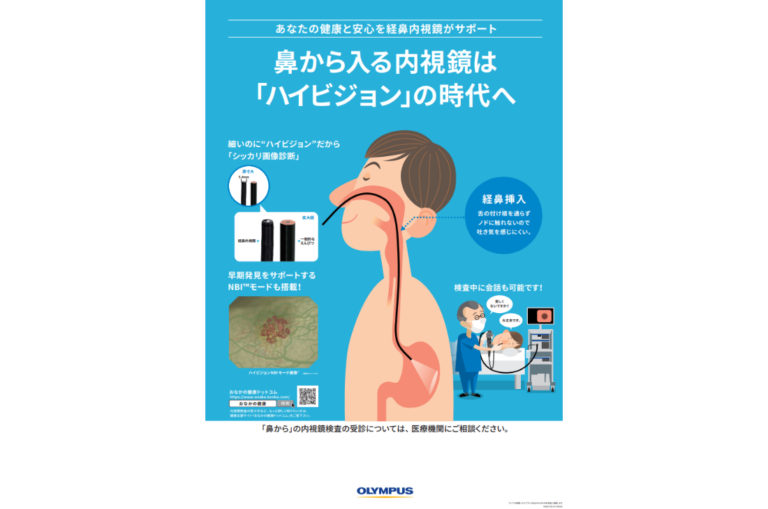 鼻から入る内視鏡は「ハイビジョン」の時代へ