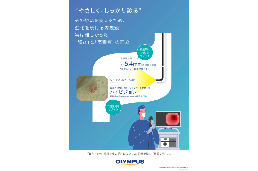 進化を続ける内視鏡、実は難しかった「高画質」と「細さ」の両立 当院はこの課題をクリアした最先端の内視鏡で胃の内視鏡検査が行えます