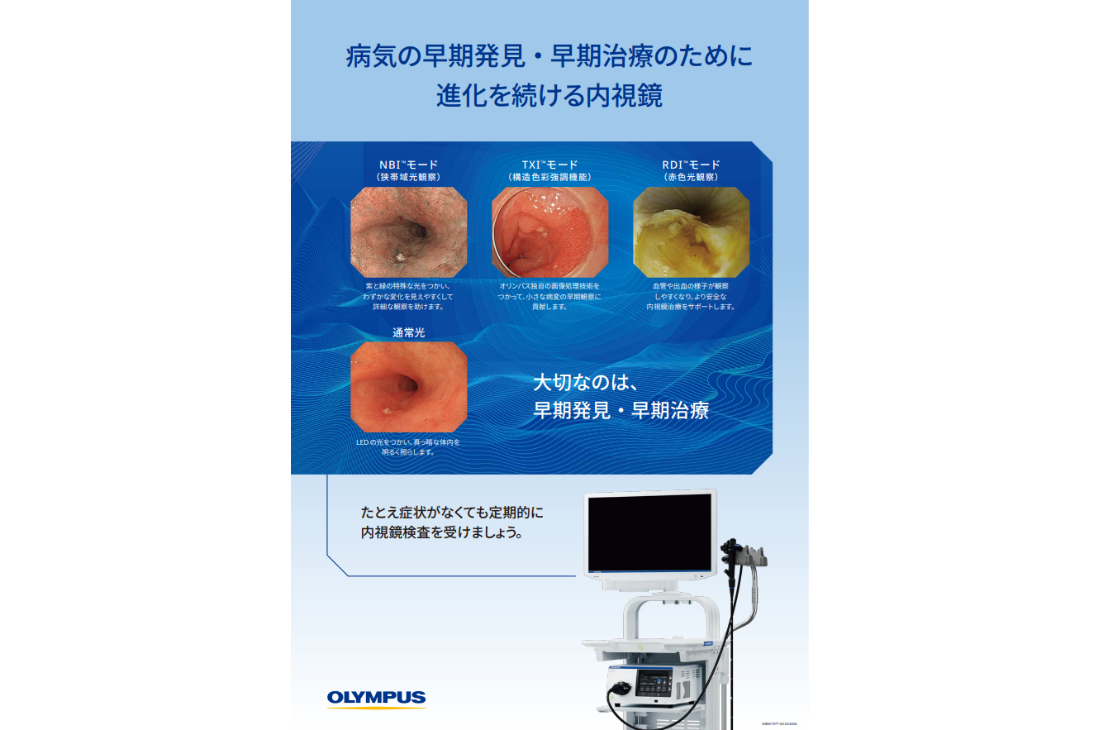 病気の早期発見・早期治療のために進化を続ける内視鏡