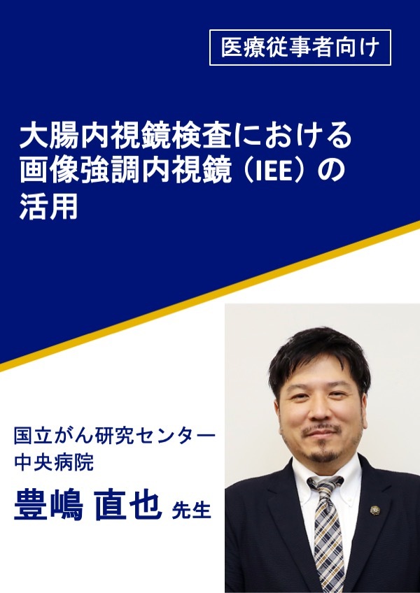 大腸内視鏡検査における画像強調内視鏡（IEE）の活用