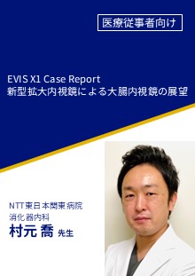 新型拡大内視鏡による大腸内視鏡の展望